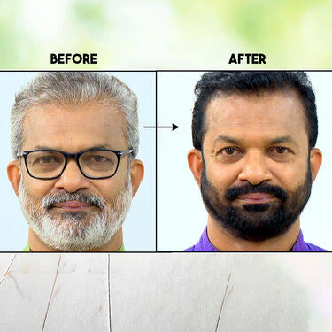 Keragain Color Shampoo & Serum Combo | 🔥Buy 1 Get 1 Free 🔥